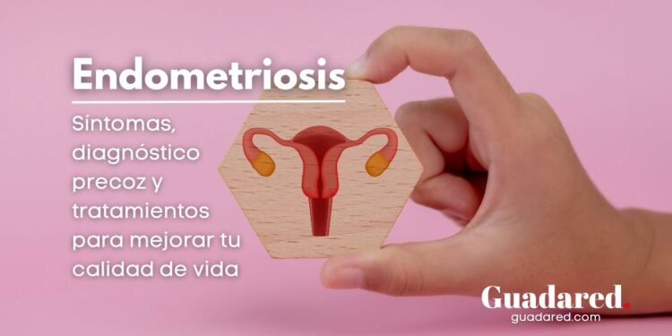 Endometriosis: síntomas, diagnóstico precoz y tratamientos para mejorar tu calidad de vida