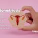 Endometriosis: síntomas, diagnóstico precoz y tratamientos para mejorar tu calidad de vida